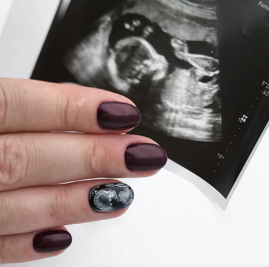 jak dbać o paznokcie w ciąży?